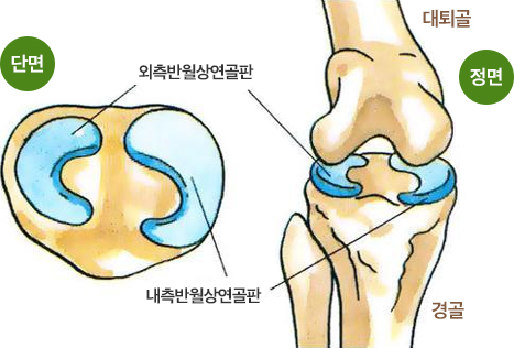 반월상 연골판의 단면과 정면 이미지